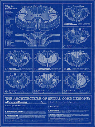 Spinal Cord Lesions poster