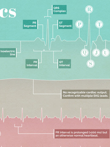 Knurre Forkæl dig forkæle Electrocardiography Basics Poster – NerdcoreMedical