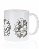 Anatomical Brain Mega Mug